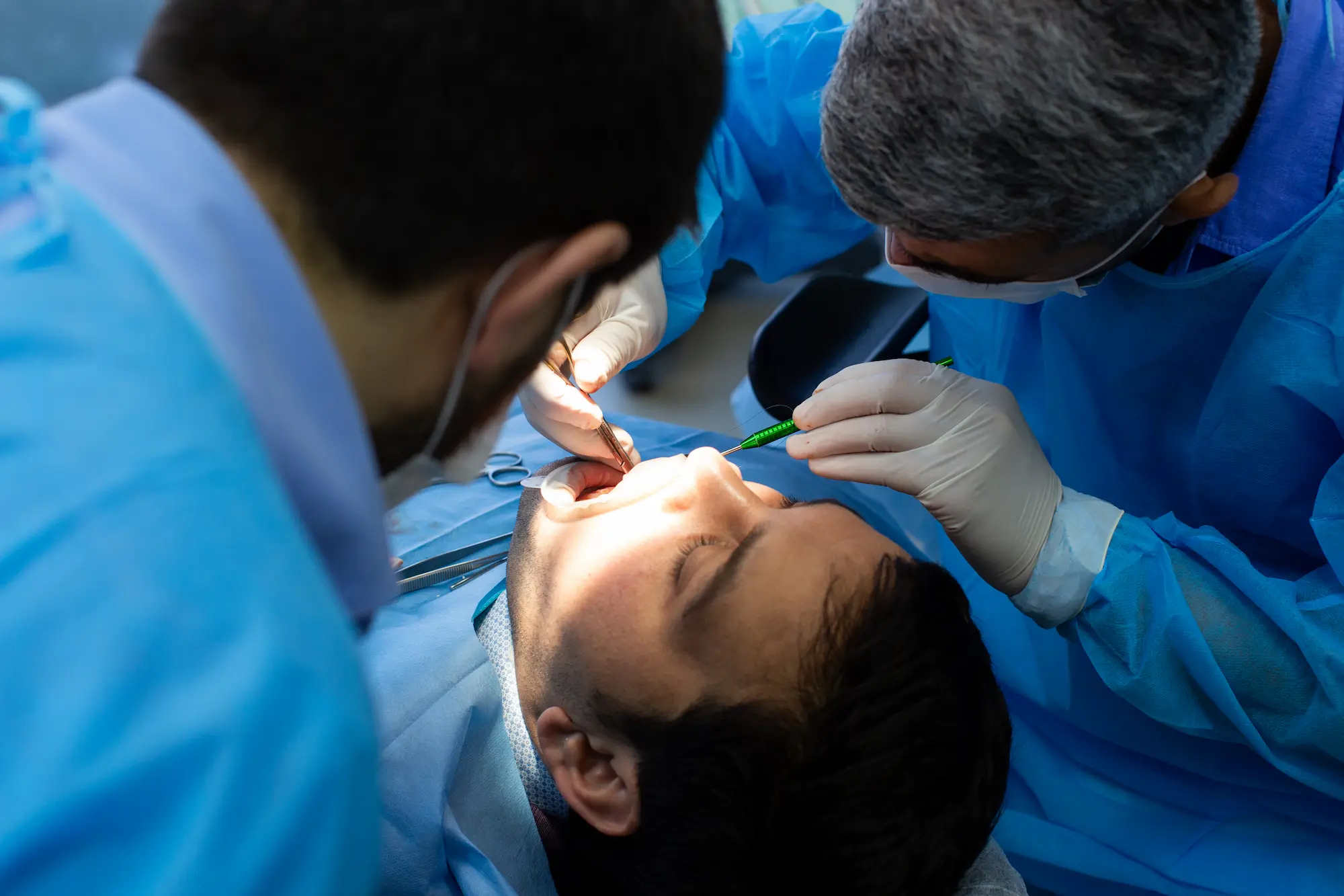 Cirujano maxilofacial en Alhaurín de la Torre