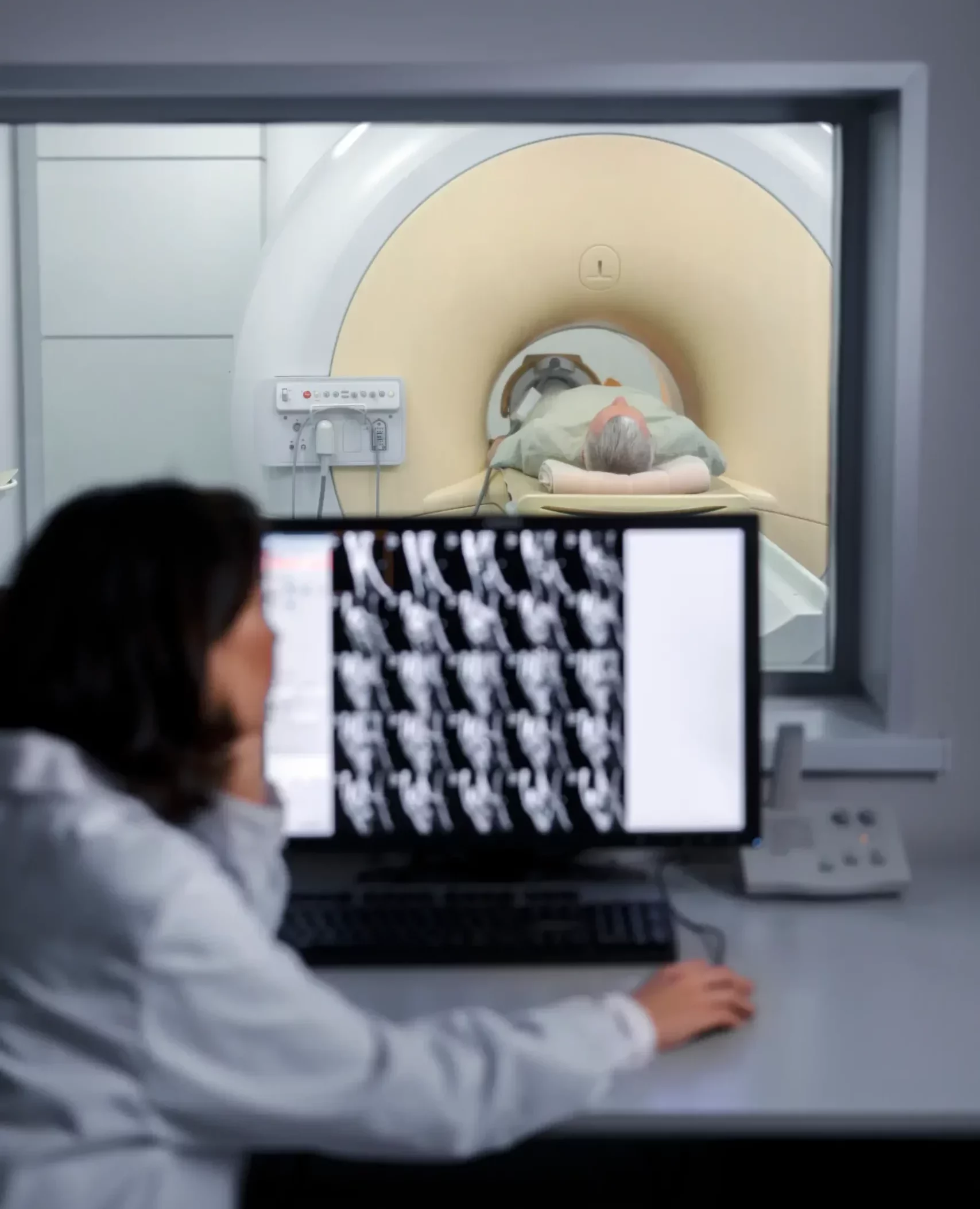 Radiodiagnóstico resonancia