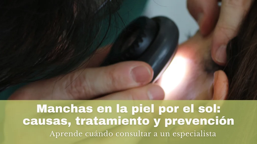 Manchas en la piel por el sol: causas, tratamiento y cómo prevenirlas