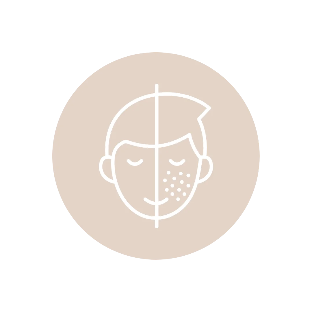 dermatología en alhaurín