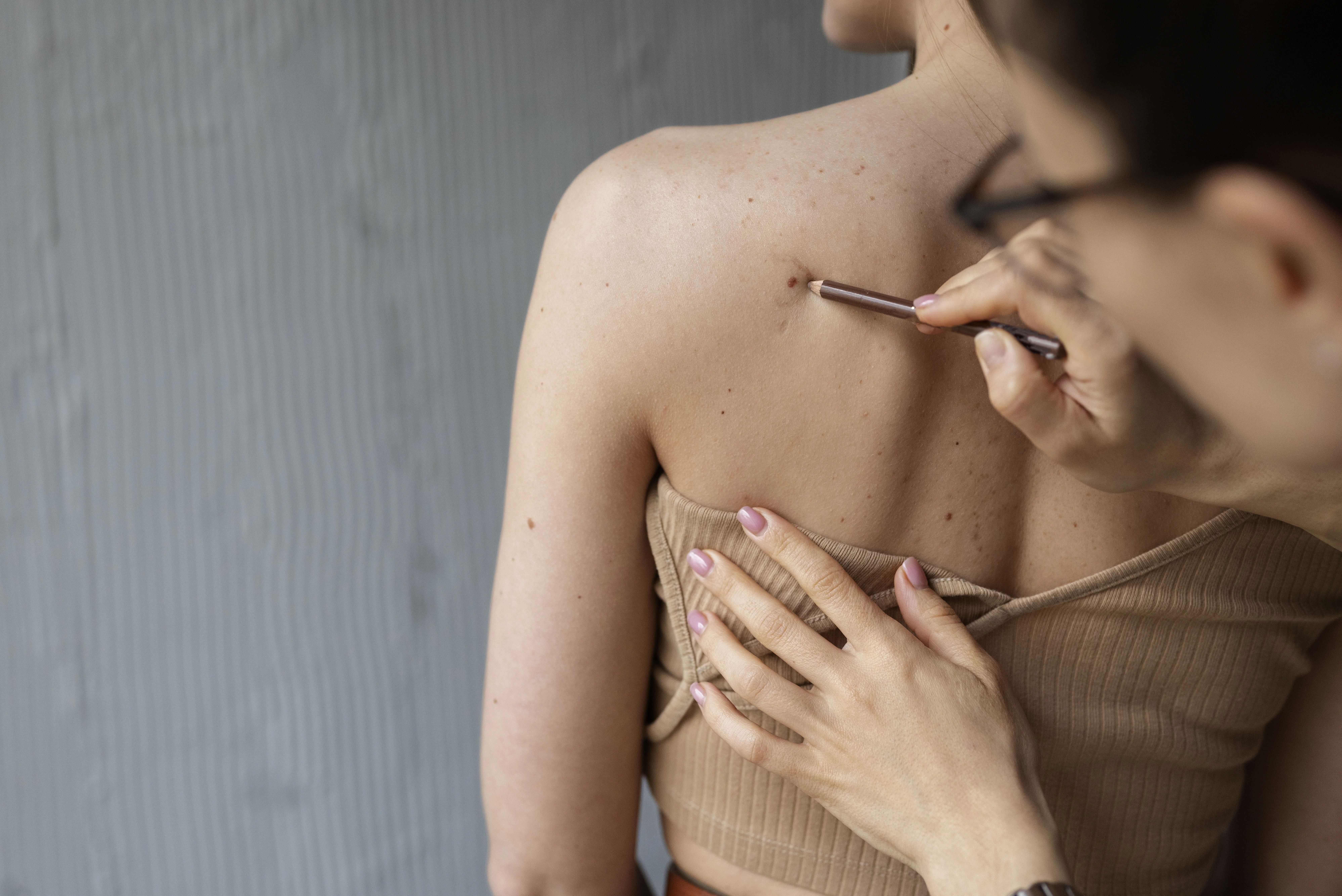 Dermatología en Alhaurín